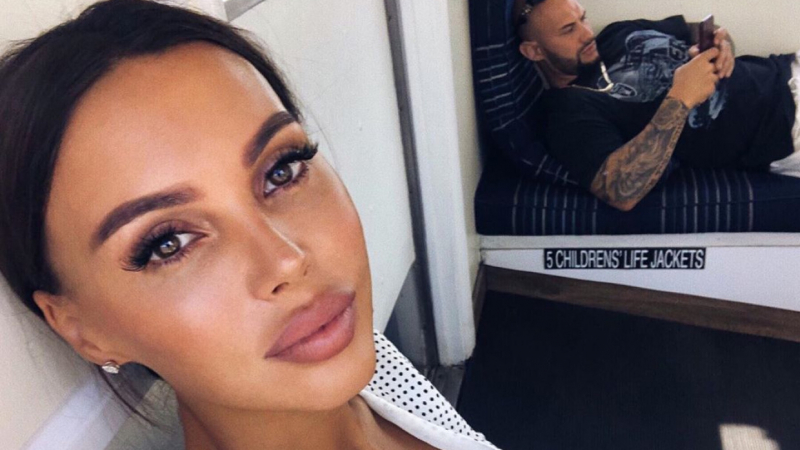 Оксана Самойлова шокировала поклонников чересчур огромными губами