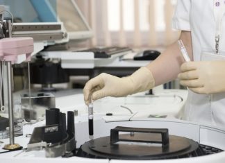 Роспотребнадзор выявил маркер, который указывает на поражение сосудов при COVID-19