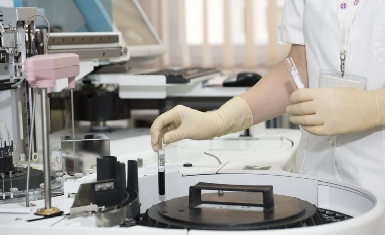 Роспотребнадзор выявил маркер, который указывает на поражение сосудов при COVID-19 